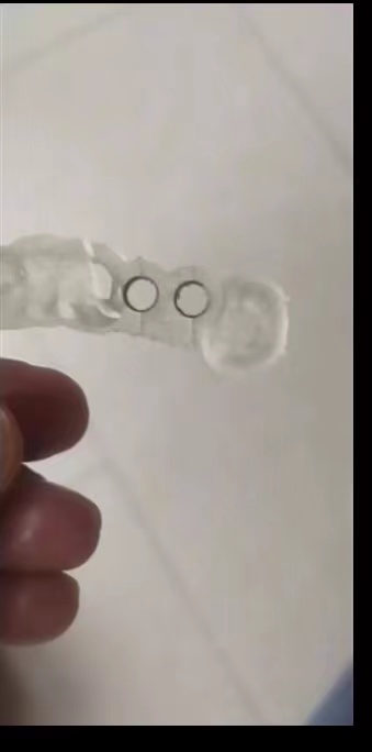 Resin Dental 3D Printer Planti - огляд і ціна Glue For 3D Printing